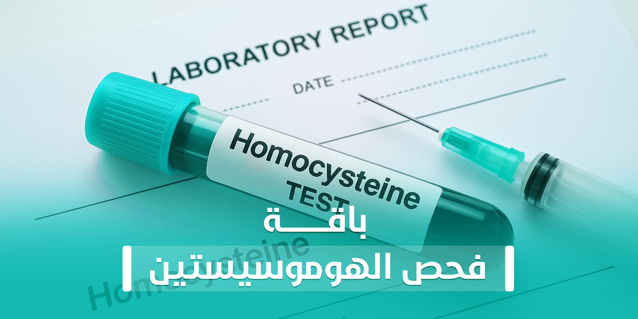 باقة فحص الهوموسيستين