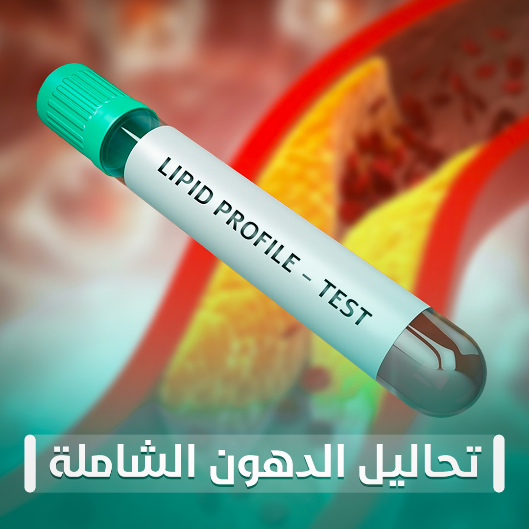تحاليل الدهون الشاملة