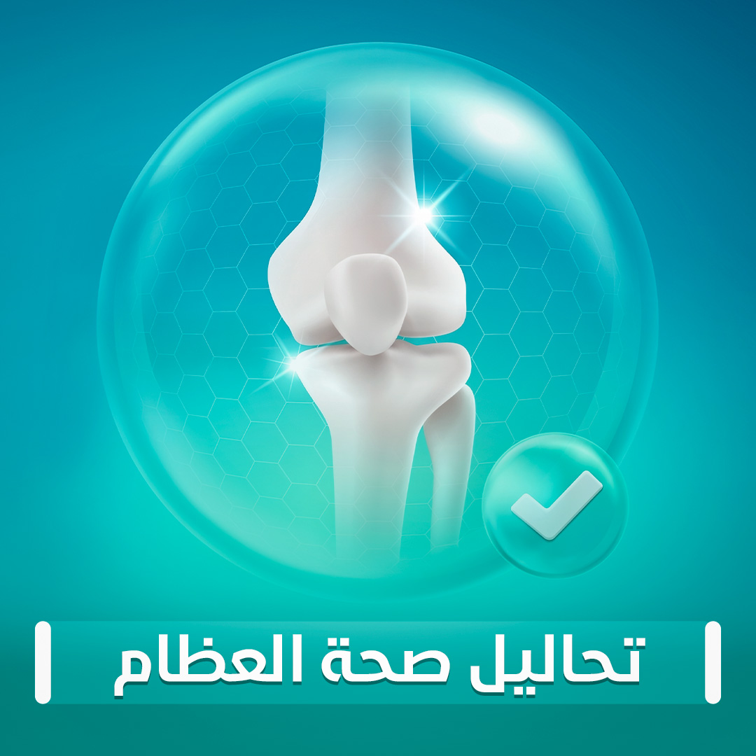 تحاليل صحة العظام