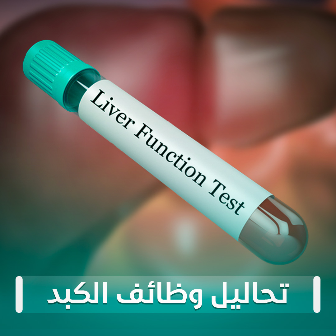 تحاليل وظائف الكبد