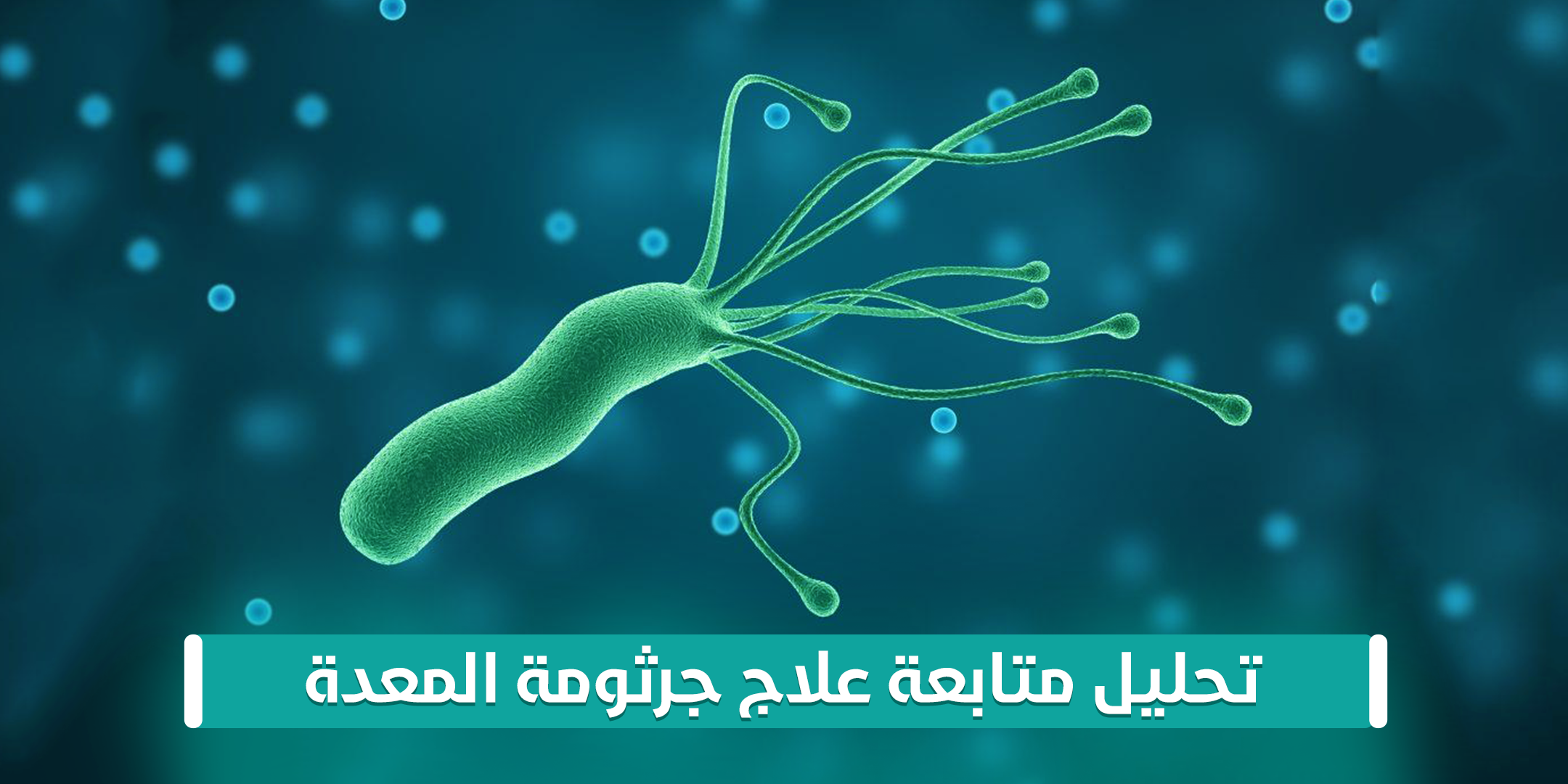 تحليل متابعة علاج جرثومة المعدة