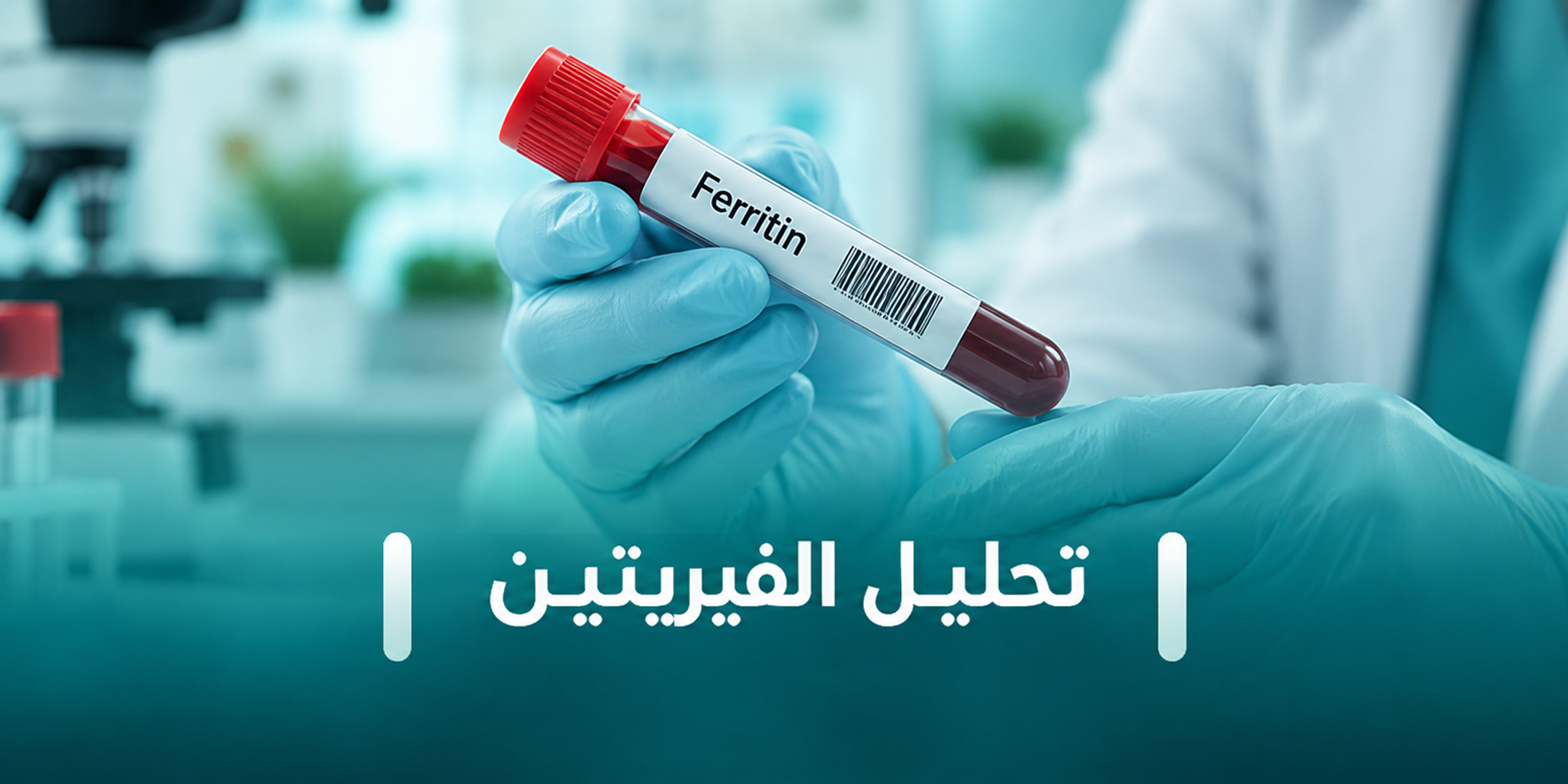 تحليل الفيريتين